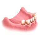 Изображение зубов при частичной адентии
